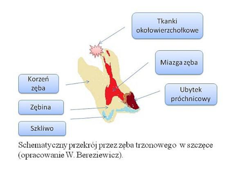 Jakie są najlepsze metody leczenia bólu po zakładaniu plomb?