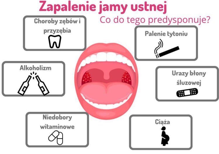 Jakie są objawy zapalenia jamy ustnej?