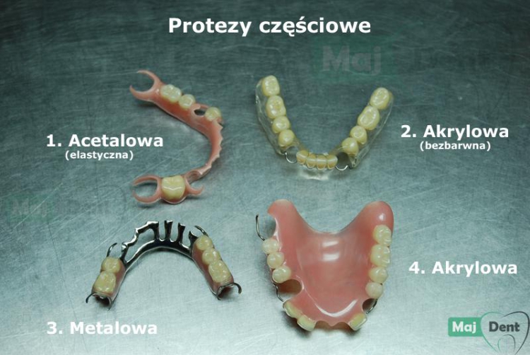 Jakie są zalety i wady protez szkieletowych?